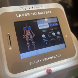 Epilation définitive Laser HD matrix - depil beaute - scarlett the beauty centre - braine l'alleud -grossiste esthétique