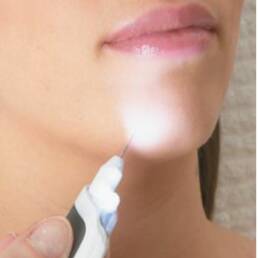 Electrolyse - Depil 520 - 670- aiguille lumiere -depil beaute - scarlett the beauty centre - braine l'alleud -grossiste esthétique