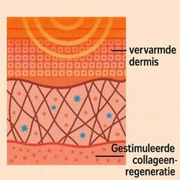 Professionele laser voor huidverjonging en huidverbetering in esthetische instituten – Dépil Beauté